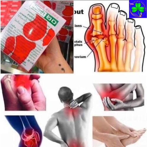 thuốc khớp Noxa 20 thái Lan
